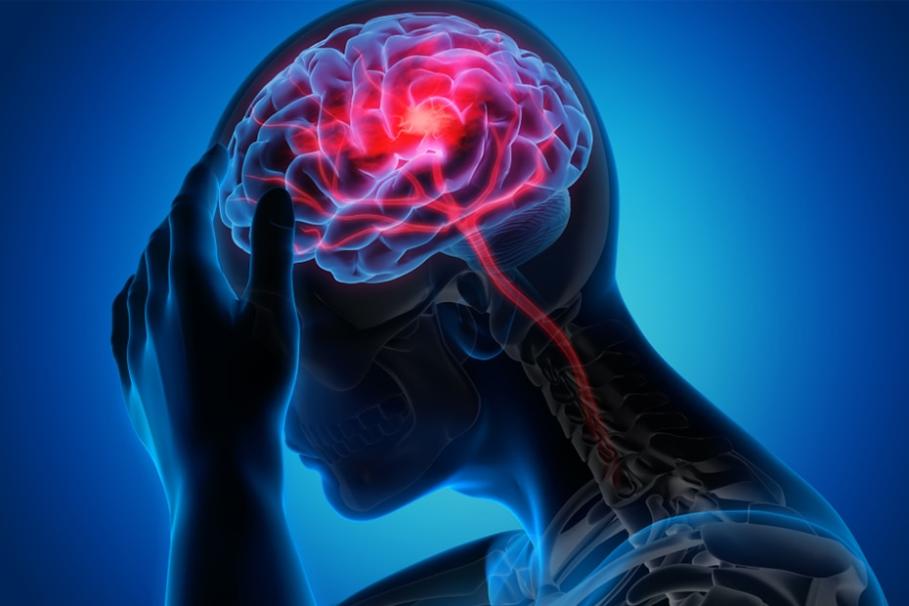How Do I File a Claim for Stroke Insurance Coverage?